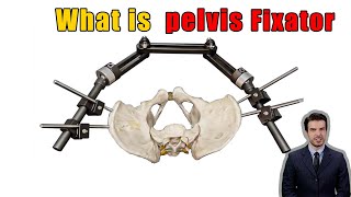 Everything You Need to Know About Pelvis Fixator B for Pelvic Fractures [upl. by Ylrrad]