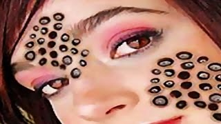 Trypophobia Cures How to Treat Trypophobia [upl. by Hnacogn]