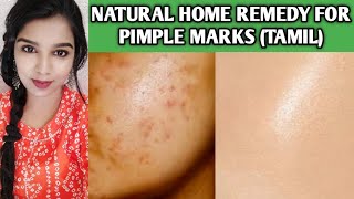 How to Remove Pimple MarksAcne scars PermanentlyHome remedies for pimple marks removal in tamil [upl. by Kuehnel]