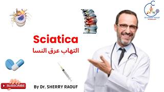 عرق النسا التهاب العصب الوركي Sciatica  Causes Signs and Symptoms Diagnosis and Treatment [upl. by Marketa]