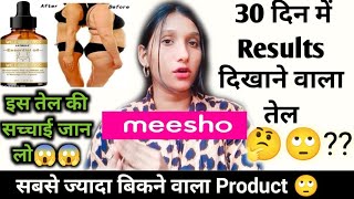 latibule weight loss oilHonest Review 2022MeeshoBeautywithnisha2M [upl. by Hinson53]