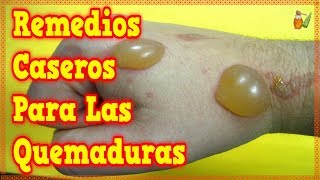 REMEDIOS PARA LAS QUEMADURAS  El Increíble Poder De Estos 3 Productos [upl. by Fital322]