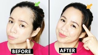 How To Naturally Grow Back Thinning Hairline amp Cover up Receding HairlineBeautyklove [upl. by Elumas816]