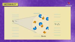 Western blot  Southern blot  Northern blot  South western Blot  Animation [upl. by Ludeman]