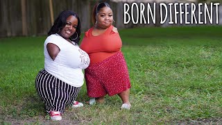 7 Extraordinary People Living Without Limbs  BORN DIFFERENT [upl. by Cynthla936]