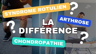 Syndrome rotulien chondropathie et arthrose Quelle différence [upl. by Perrie]