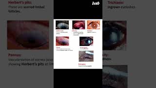 Trachoma ophthalmology inicet neetpg fmge [upl. by Tnirb908]