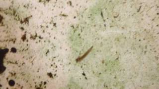 Fly Fishing Entomology  Midge Chironomidae Larvae Stage Video [upl. by Redwine267]