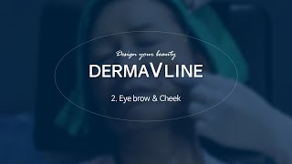 DERMAVLINE Full Face Lifting EyebrowampCheek [upl. by Anaehs71]