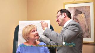 El Paso Cosmetic Surgery Dr Ozan Sozer MidFace Lift [upl. by Gnuhp]