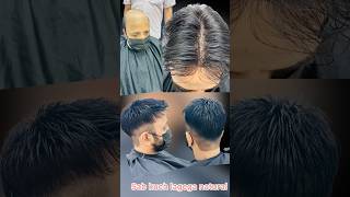 9899746489 Natural Skin Hair Patch in Delhi explore skin look amazing explorepage reels viral [upl. by Yssirhc]