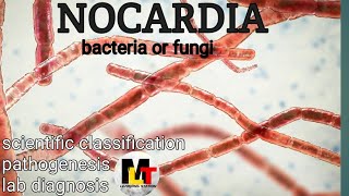 Nocardia ।। IntroductionScientific Classification Pathogenesis Laboratory Diagnosis of Nocardia [upl. by Liu552]