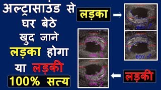 अल्ट्रासाउंड रिपोर्ट से पता करे गर्भ में लड़का है या लड़की  Gender Prediction Test In Pregnancy [upl. by Hedley]