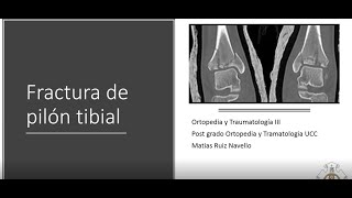 Fracturas de pilón tibial  Dr Ruiz Navello [upl. by Yeslah]