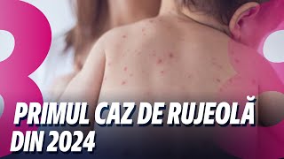 News Show Primul caz de rujeolă din 2024 Contrabandă de milioane 23012024 [upl. by Ecnerol]