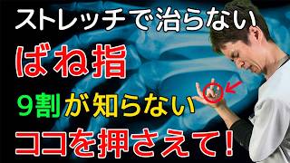 【バネ指 腱鞘炎】中指、薬指、親指のバネ指はココを押さえて徹底改善！【指の痛み治し方】 [upl. by Lavoie]