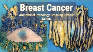 Breast Cancer  Anatomical Pathology Grossing Review Series [upl. by Barboza]