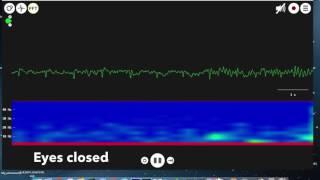 EEG Arduino Alpha waves [upl. by Herzig596]