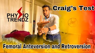 What Is Femoral Anteversion amp Retroversion and How To Test Physio trendz Physical therapy [upl. by Notserp]