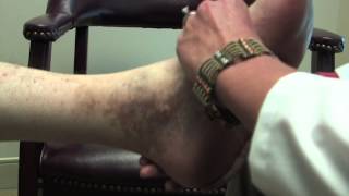 Chronic Venous Insufficiency and Wounds with Houston Surgeon Dr Peter Morgan [upl. by Leaw708]