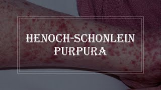 HenochSchonlein Purpura  purple rash on skin vasculitis [upl. by Refannej208]