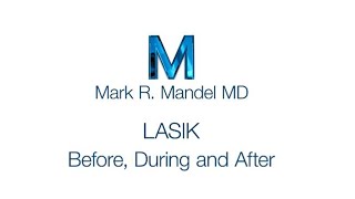 LASIK  Before During and After [upl. by Ofloda]