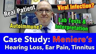 Case Study 40 y woman with Ménières disease hearing loss ear pain tinnitus [upl. by Cardie]