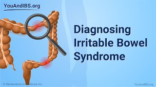 Diagnosing Irritable Bowel Syndrome [upl. by Freya]