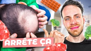 Vous perdez vos cheveux  Essayez ces 6 aliments  alopécie calvitie [upl. by Gratia]