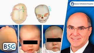 Craniosynostosis Grand Rounds  Neurosurgery Course  February 21 2023 [upl. by Carrnan132]