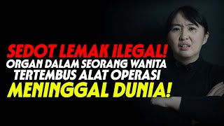 AKIBAT SEDOT LEMAK ILEGAL❗️KASUS NYATA❗️ [upl. by Ajim]