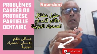 Problèmes causés du prothèse partielle dentaire مشاكل طقم الاسنان المتحرك الجزئية وحلولها [upl. by Tezil]