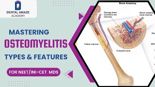 Mastering Osteomyelitis Types amp Features For NEETINICET MDS [upl. by Euton507]