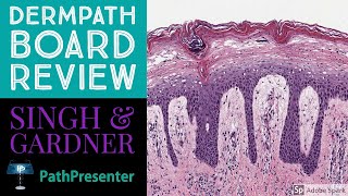 Dermpath Board Review 100 Classic Cases [upl. by Tengler]