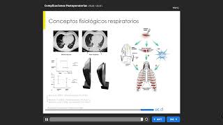 059 Complicaciones Postoperatorias [upl. by Ahseinet]