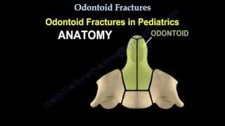 Odontoid Fractures  Everything You Need To Know  Dr Nabil Ebraheim [upl. by Leonardo773]