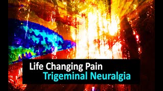 Life Changing Pain Trigeminal neuralgia [upl. by Anelec]