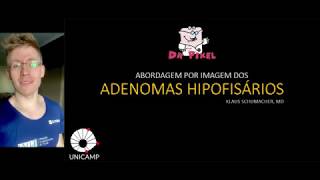 ADENOMAS HIPOFISÁRIOS  Abordagem radiológica inicial [upl. by Ahsenev]