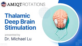 Michael Lu Thalamic Deep Brain Stimulation for Closed Head injury [upl. by Elbas]