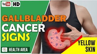 3 Early Warning Signs of Gallbladder Cancer  Gallbladder Cancer Symptoms [upl. by Chaunce458]