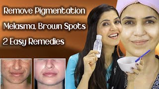 Remove Pigmentation Melasma Freckles Brown Spots  Results In One Week  Ghazal Siddique [upl. by Nennek]