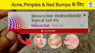 Minym Gel Review in Hindi  Minocyclic Gel How to Use  Acne Pimples amp Red Bumps  SK MEDICINE [upl. by Karr733]