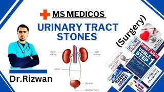 Urinary Tract Stones SurgeryMS MedicosDr RizwanUrdu Hindi Easy Explanations [upl. by Nevin]