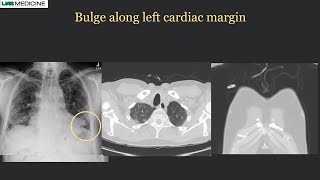 RSNA 2021 Dynamic Digital Radiography in Chest Imaging  Konica Minolta Healthcare [upl. by Nimoynib]