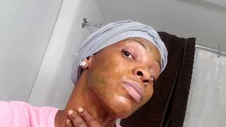 Using Jamaican Cerasee for my acne [upl. by Nivloc]