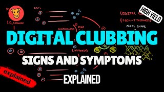 DIGITAL CLUBBING Pathogenesis of Signs and Symptoms in Medicine [upl. by Ylra]