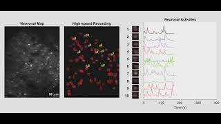 InVivo Imaging of the Neuronal Activity in Mouse Primary Visual Cortex [upl. by Darlleen221]