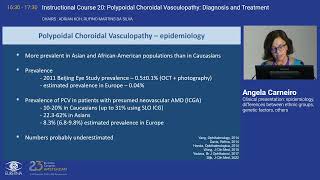 2 Clinical presentation epidemiology differences between ethnic groups genetic factors others [upl. by Essyla592]