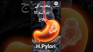 HPylori Helicobacter Pylori Signs Symptoms Lab Test and Treatment hpylori treatment shorts [upl. by Kaliope]