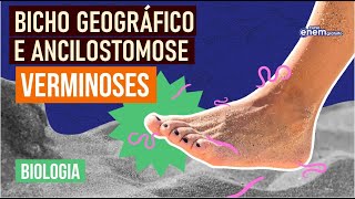 ANCILOSTOMOSE E BICHO GEOGRÁFICO tipos de verminoses  Resumo de Biologia Enem  Cláudia Aguiar [upl. by Vershen411]